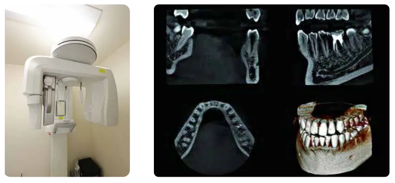 デジタルレントゲンと撮影画像