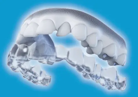 インビザライン治療